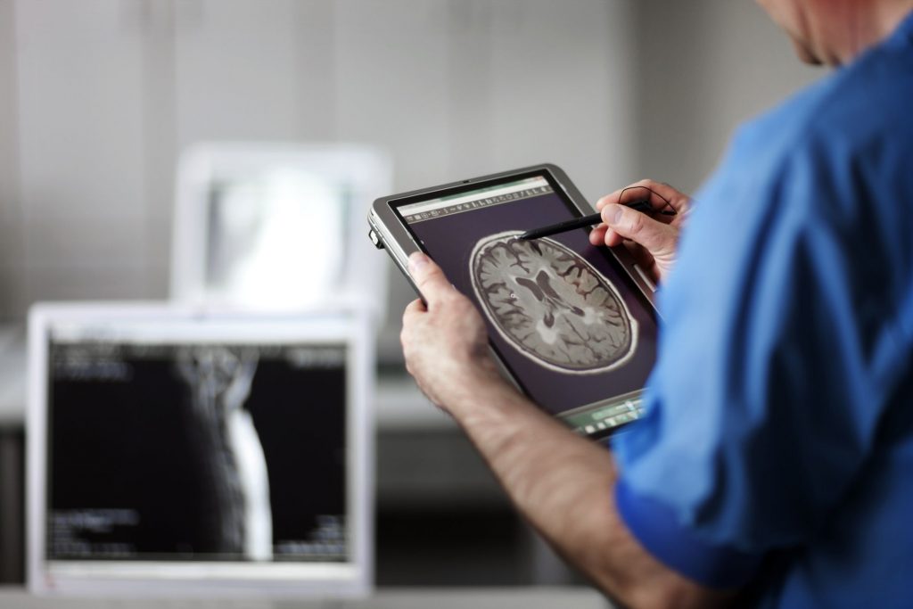 A healthcare professional looks at a computerized image of a brain.